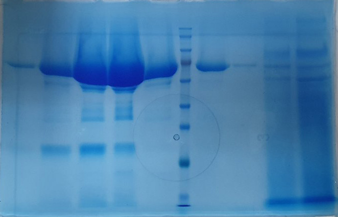 enzymes screening